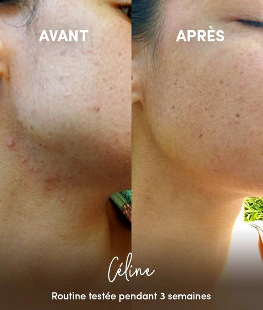 Waam Nettoyant Visage Anti-Imperfections En Poudre Bio Résultats - Ethnilink