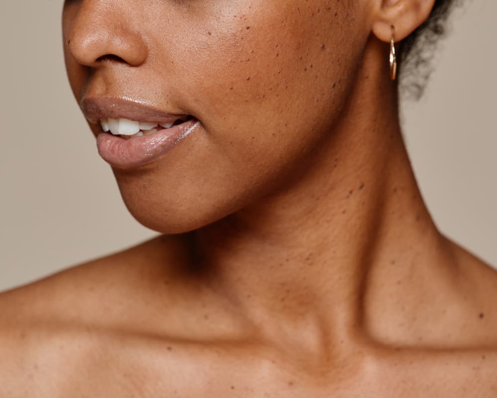 Sensitive skin