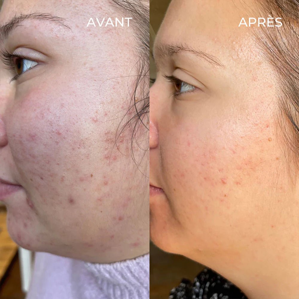 oOlution Le Serum Anti - Imperfections - Ethnilink